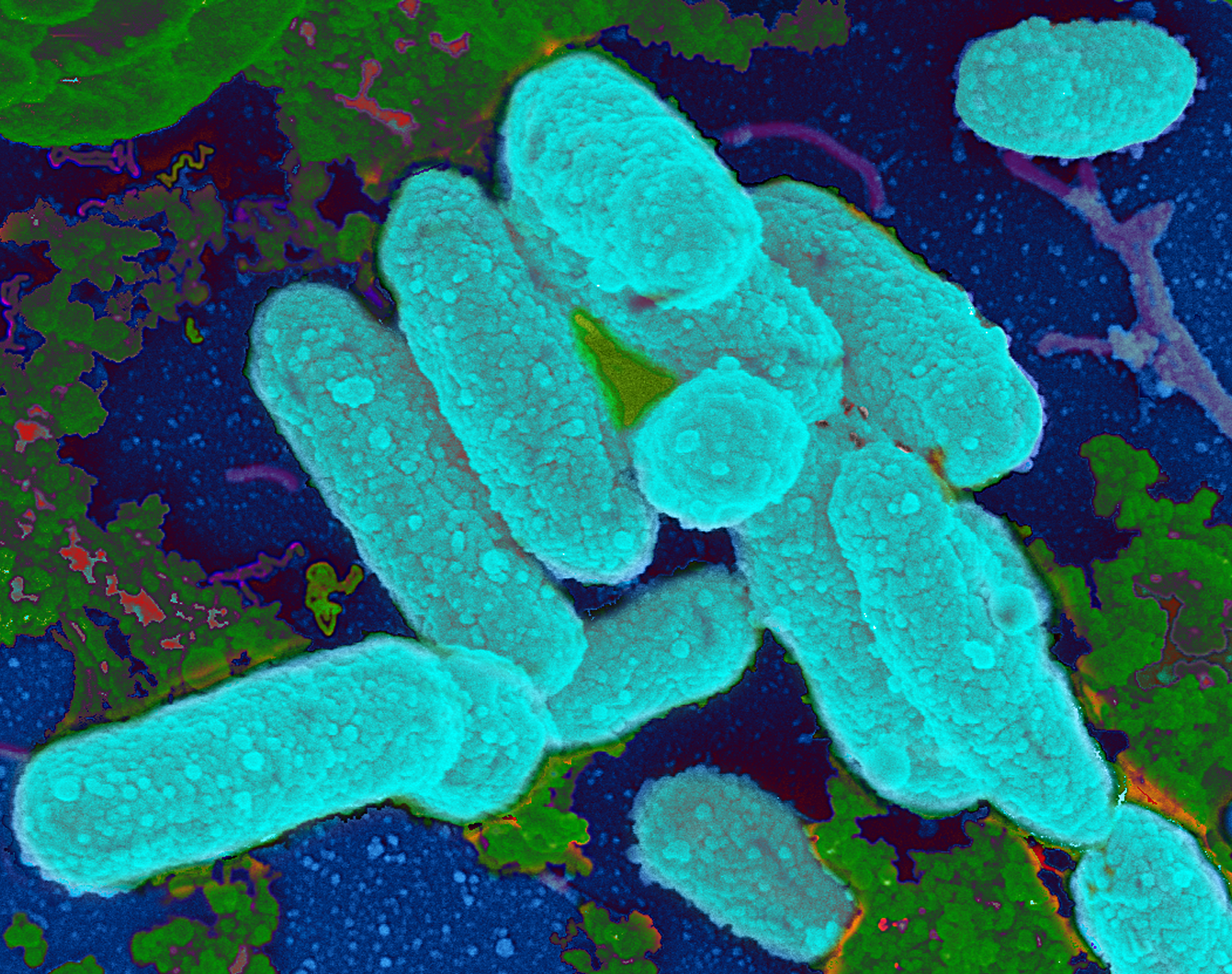 Scientists Find Link Between Antibiotics and Bacterial Biofilm